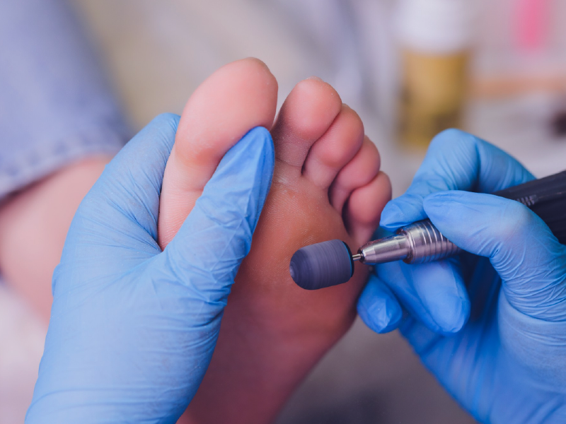 Sanapie_profilaxis_podal_cuidado_integral_del_pie_masaje_pies